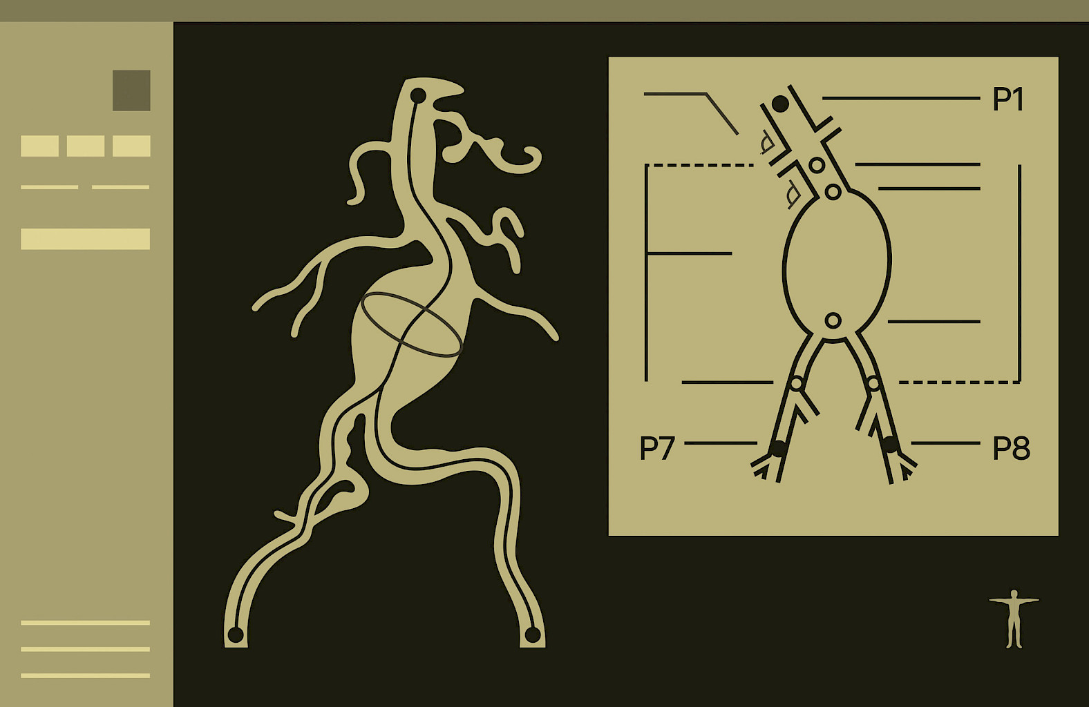 Illustration: Software interface for AI-assisted planning of cardiovascular procedures.