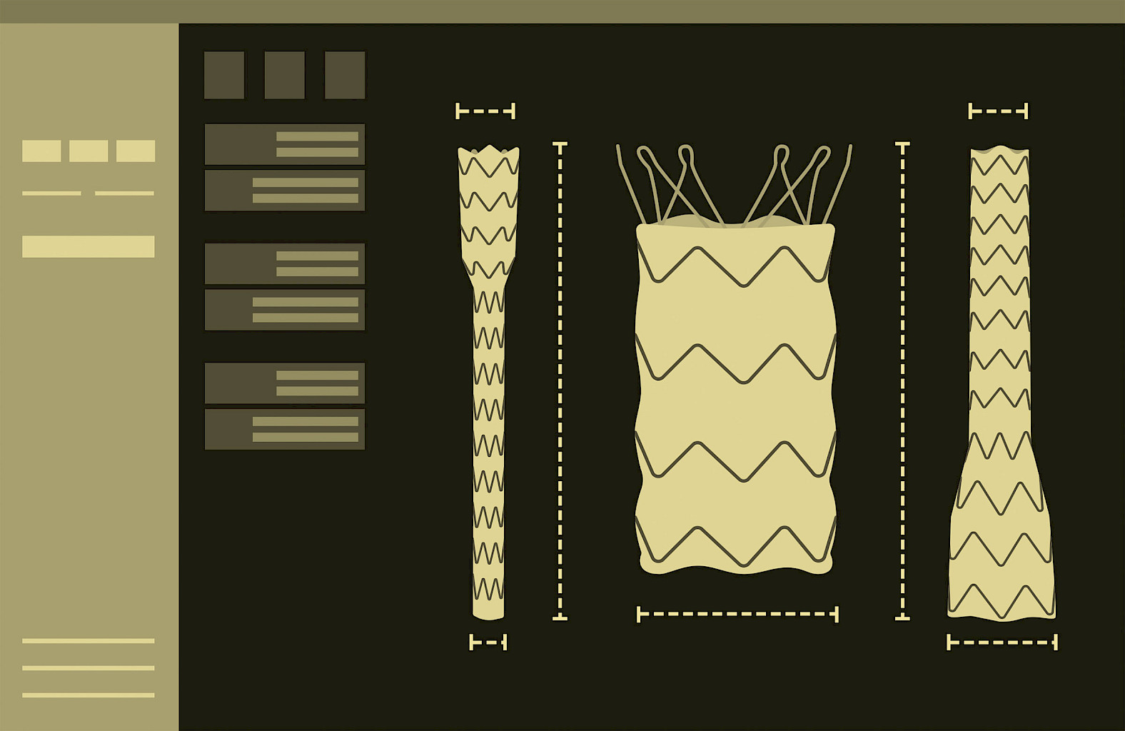 Illustration: EndoSize user interface with built-in links to appropriate endografts