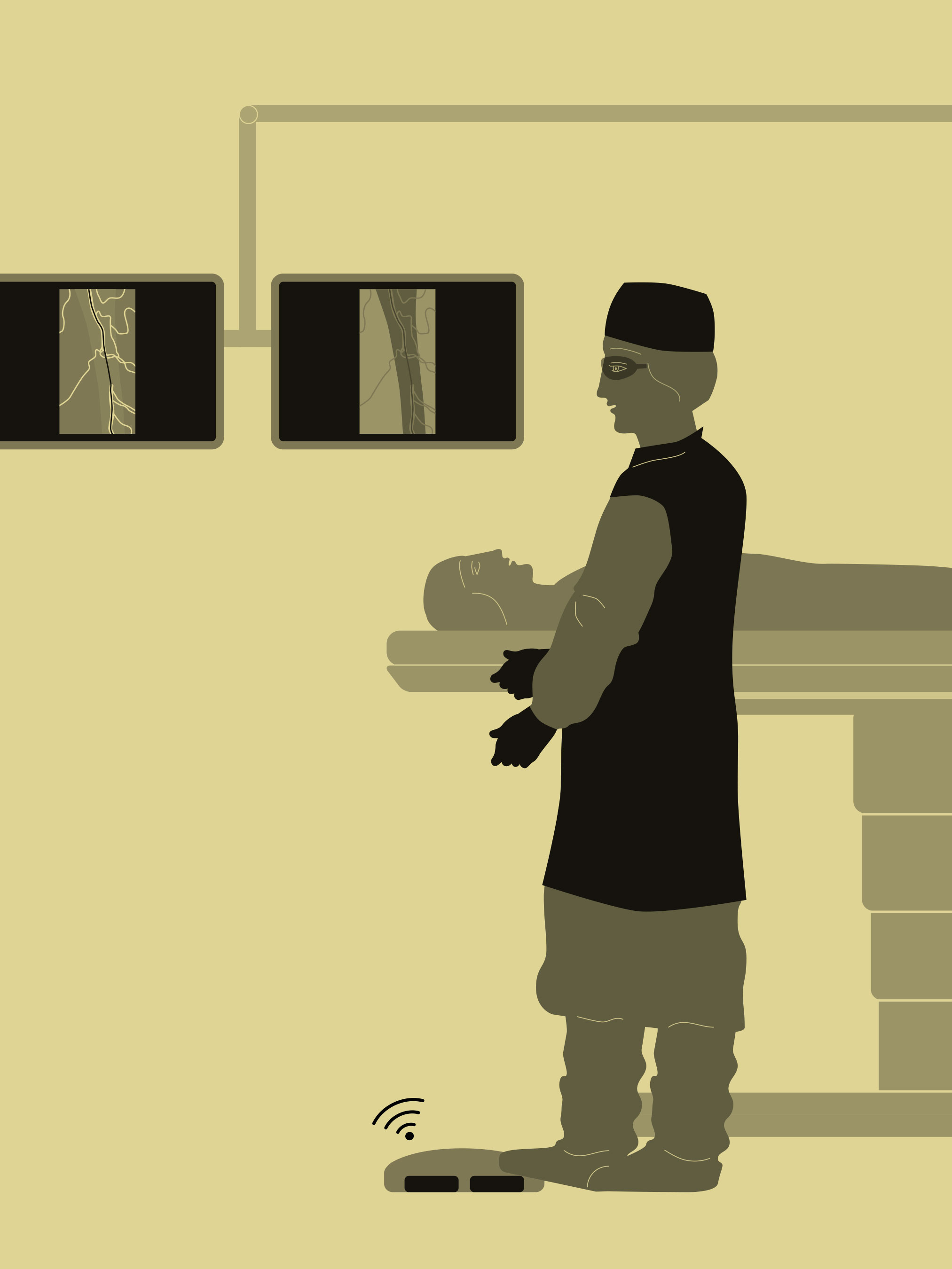 Illustration of a vascular procedure