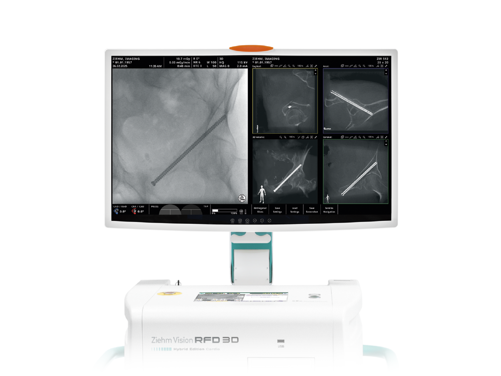 Ziehm Vision RFD 3D