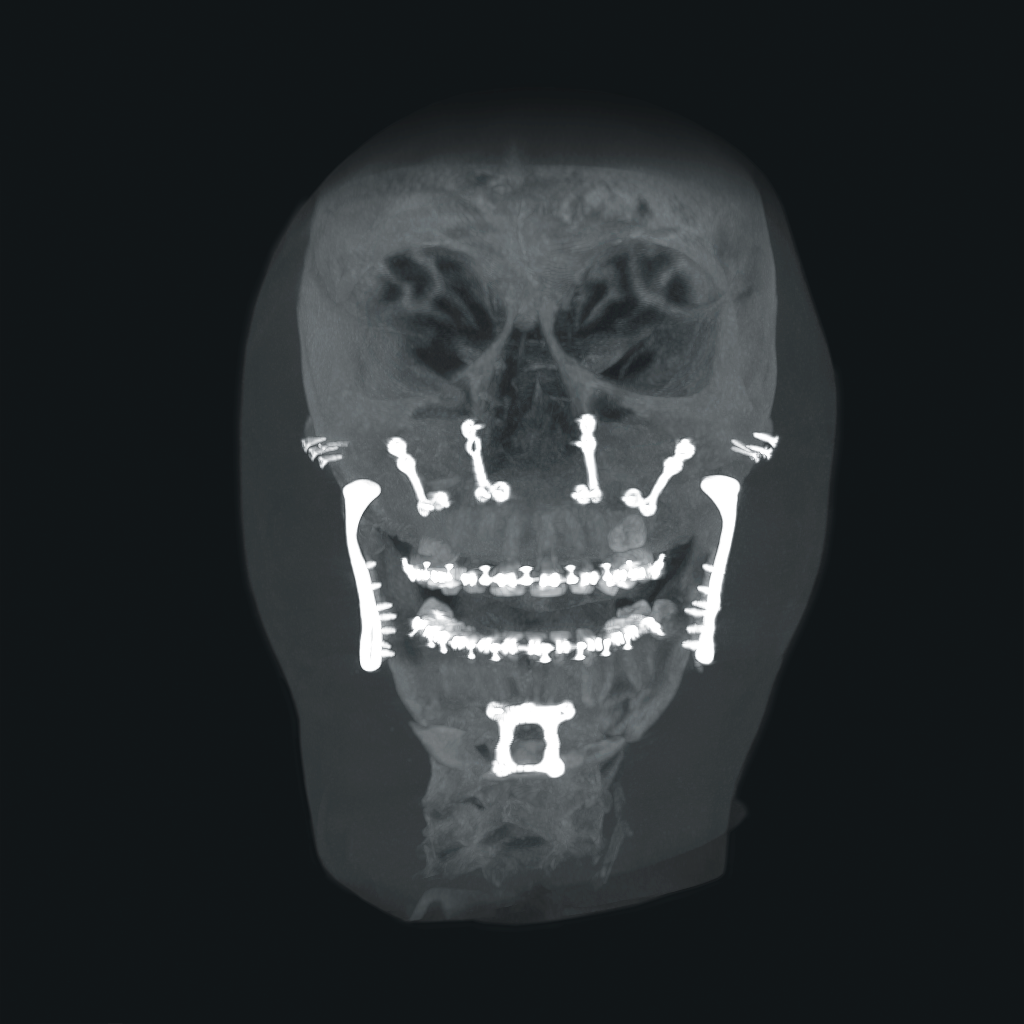 Cirurgia oral e maxilofacial