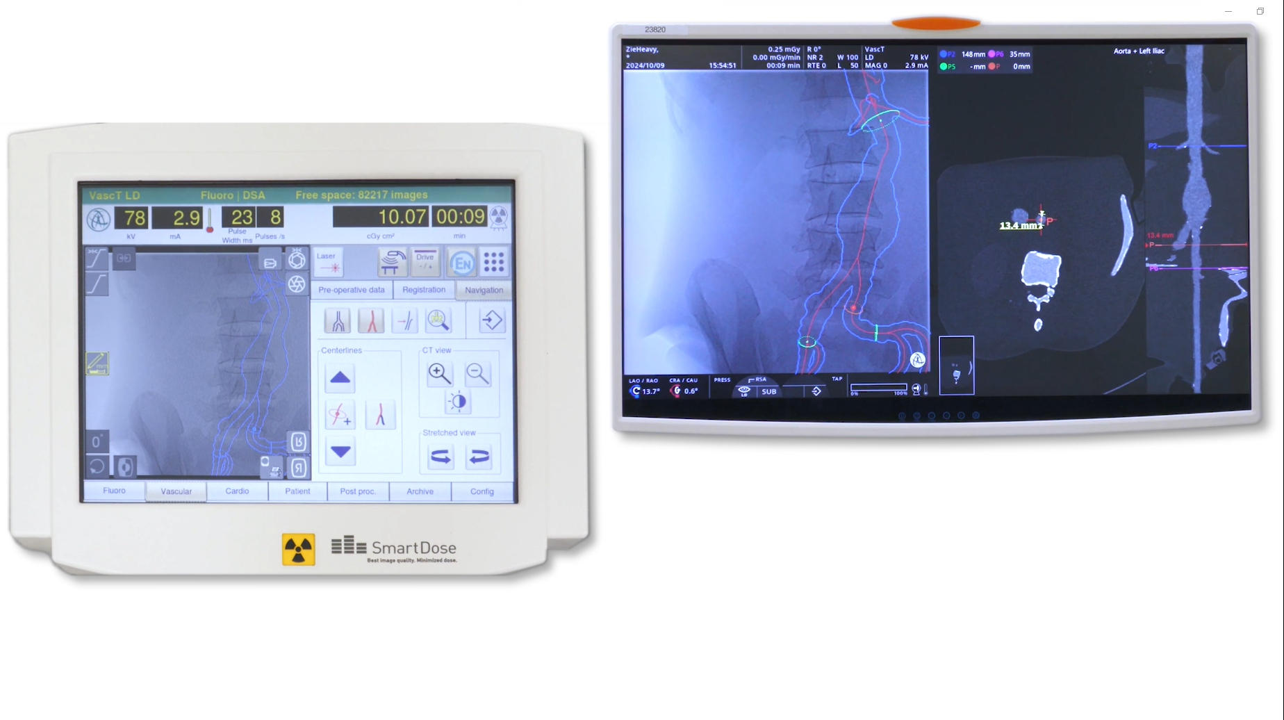 Endovascular Navigation