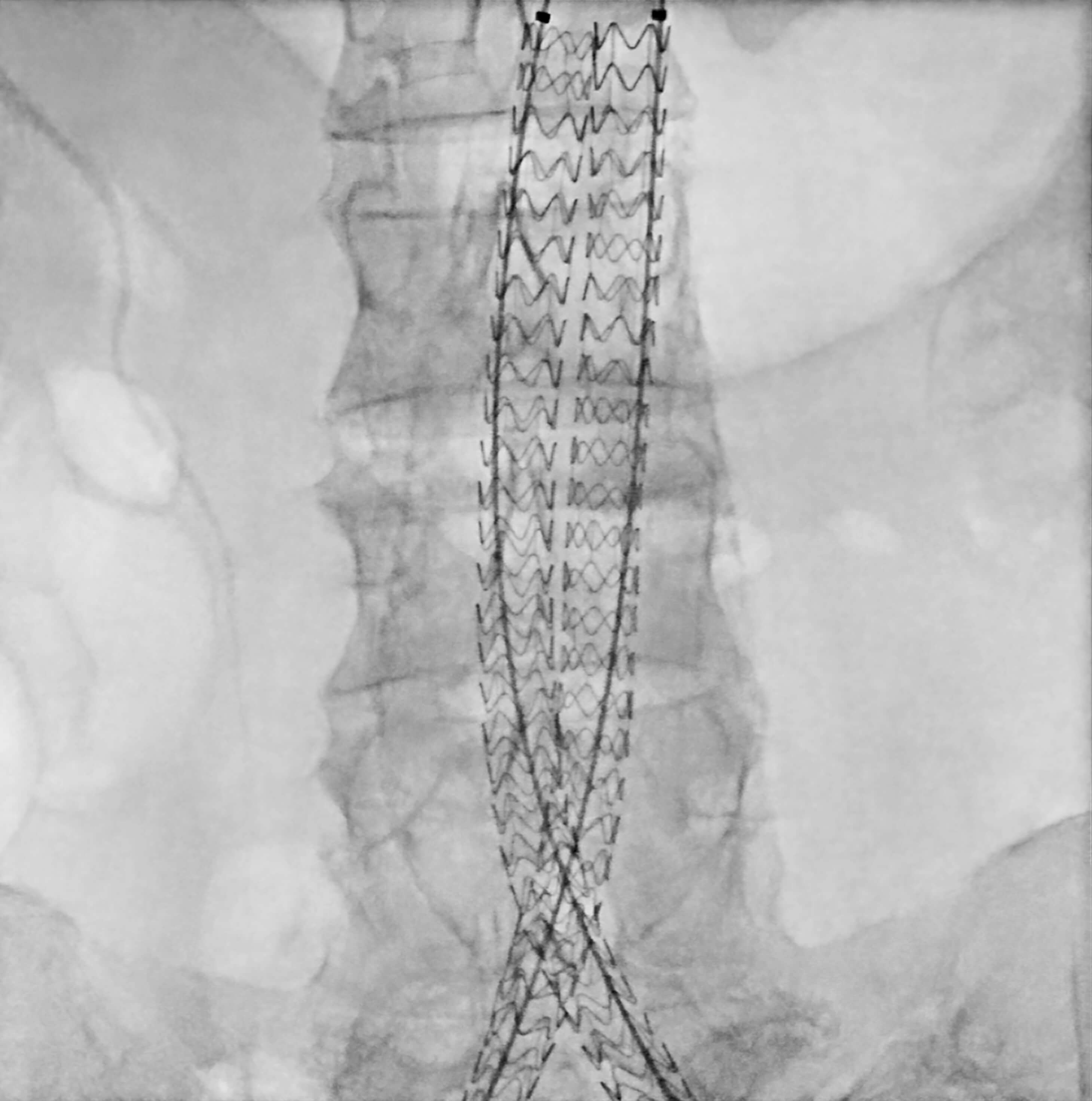 Chirurgie vasculaire