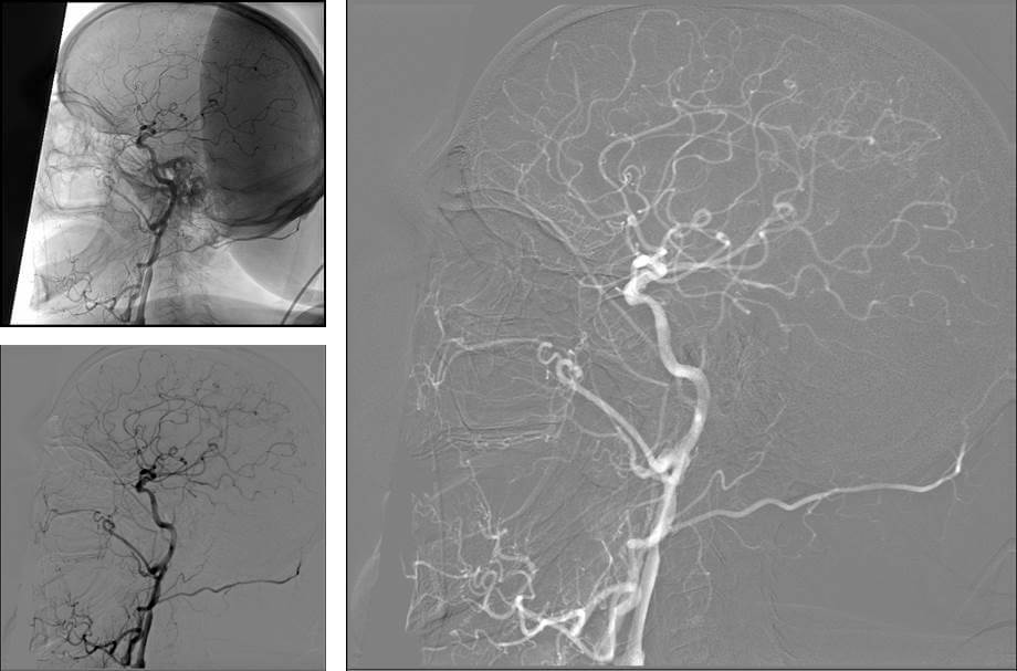 Chirurgie vasculaire