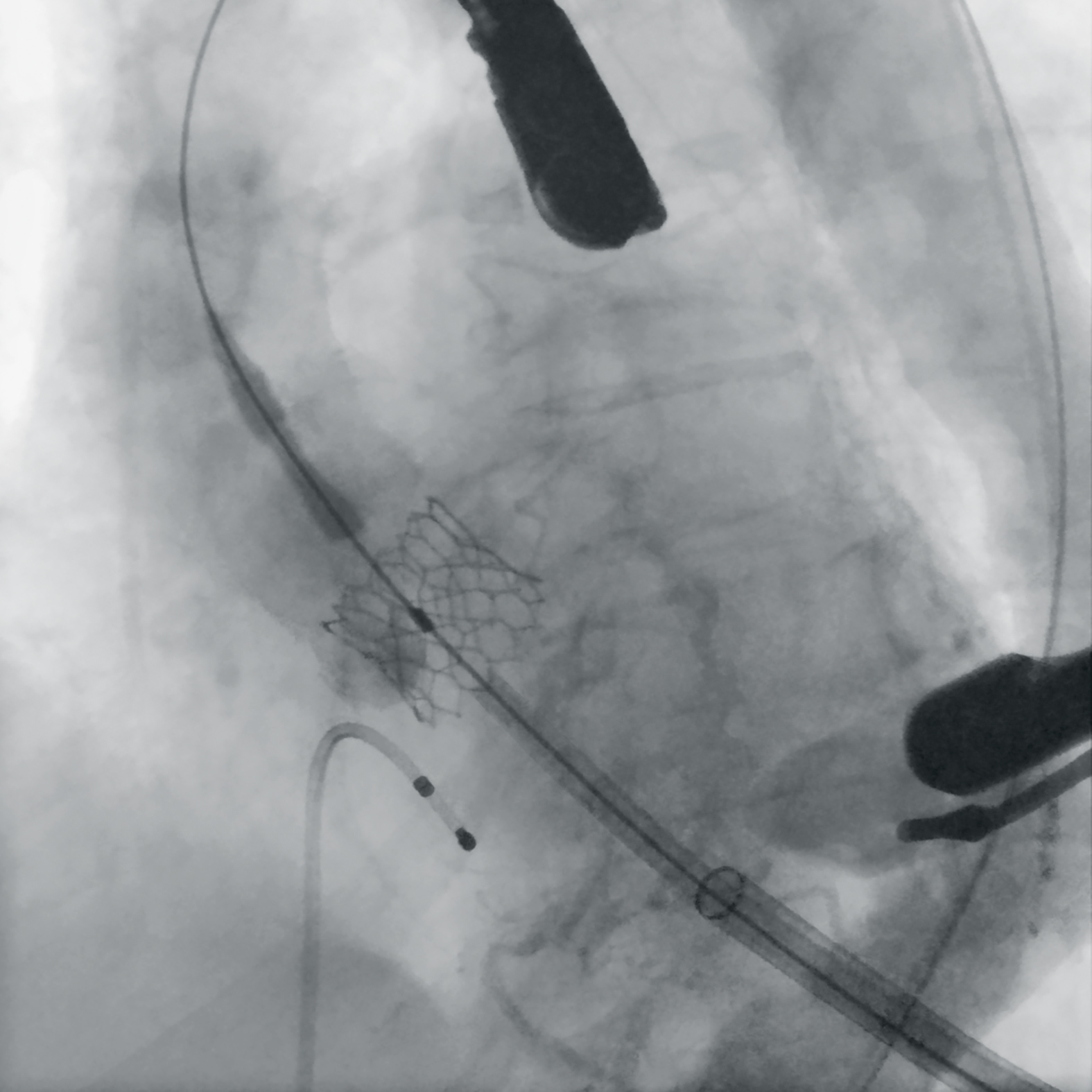 Cardiología y electrofisiología